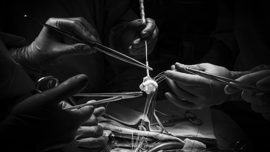 Hospital El Pilar innova su Unidad de Cardiología con el lema "Tú, nuestra razón de ser"