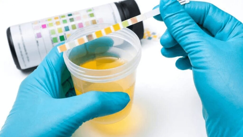 Conoce más sobre la infección del tracto urinario