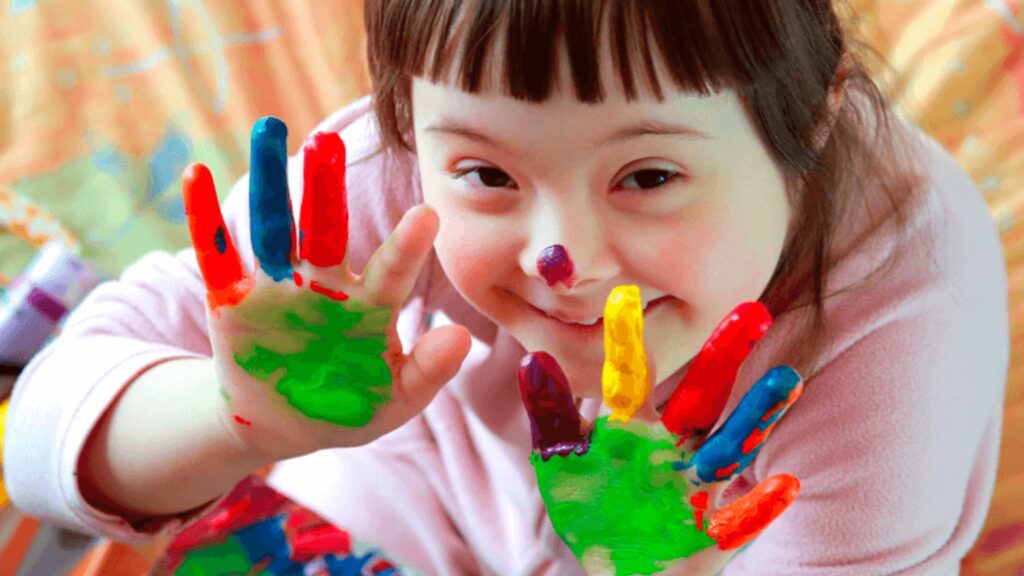 El Síndrome de Down: Una condición, no una enfermedad