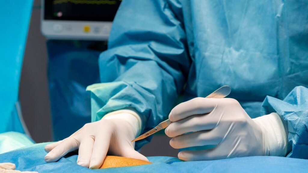 Donación de riñones en vida y avances médicos ayudan a los pacientes a evitar la diálisis