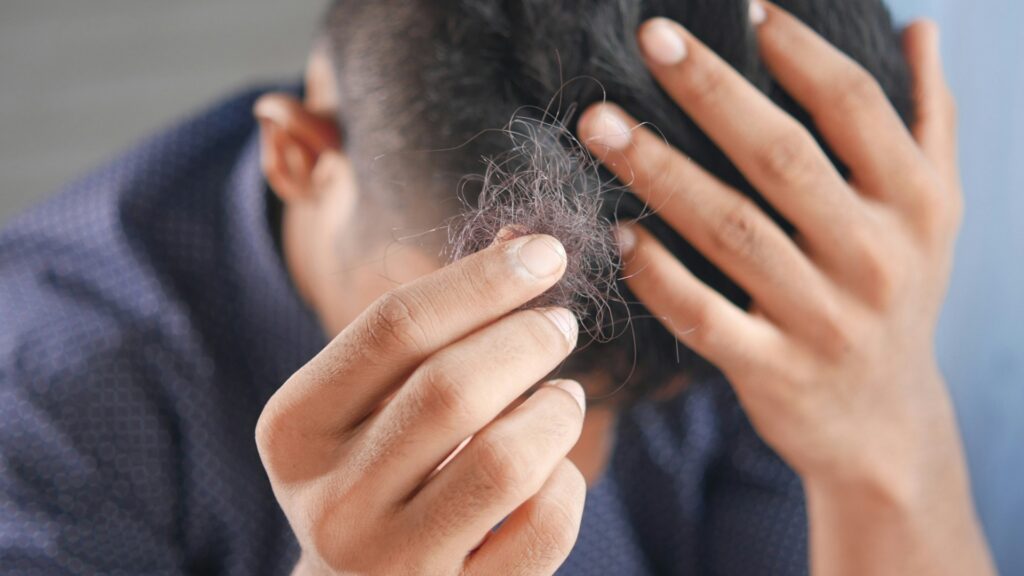 Caída del cabello: recomendaciones para prevenirla y tratarla